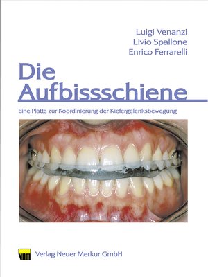 cover image of Die Aufbissschiene